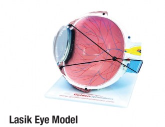 Lasik Eye Model
